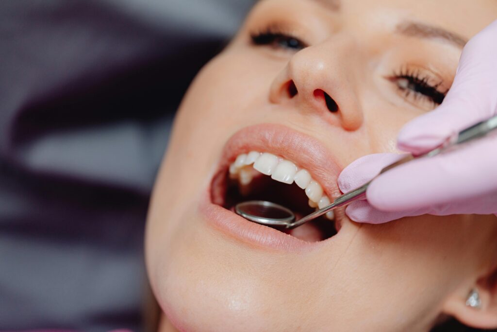 dentes